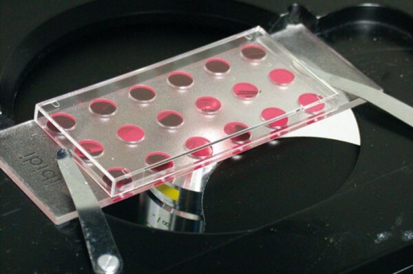 Image_Product_INS_Ibidi_81826_1000x665_JPG_02 Image_Product_INS_Ibidi_81826_1000x665_JPG_02