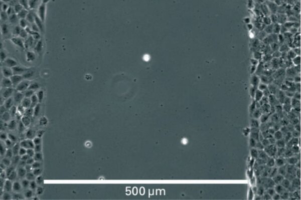 Image_Product_Ibidi_81176_1000x665_JPG_02 Image_Product_Ibidi_81176_1000x665_JPG_02