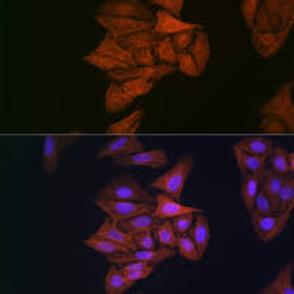 Image_Product_TEC_INS_ABclonal_Antibodies_1000x665_JPG_02 Image_Product_TEC_INS_ABclonal_Antibodies_1000x665_JPG_02