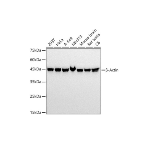 Image_Product_TEC_INS_ABclonal_Molecular-Actin_Mouse_1000x665_JPG-300x300 Image_Product_TEC_INS_ABclonal_Molecular-Actin_Mouse_1000x665_JPG-300x300