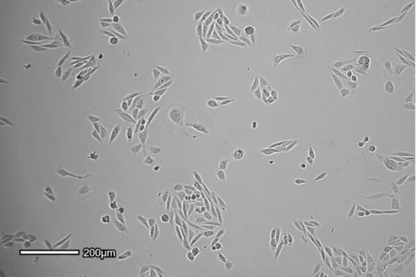 Image_TEC_INS_CytoSMART_BR_03_1000x665_JPG Image_TEC_INS_CytoSMART_BR_03_1000x665_JPG